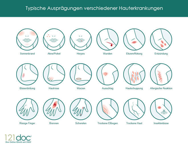 Berufsdermatosen - Hauterkrankungen